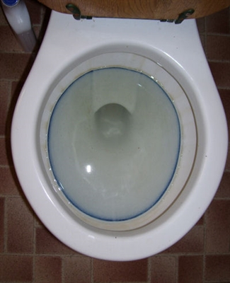 ما هي أسباب اللطخة الزرقاء في حوض المرحاض؟