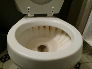 Quali sono le cause anelli neri intorno alla toilette?