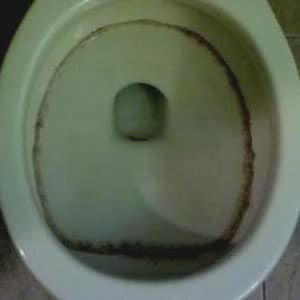 Vad orsakar svartringar runt toaletten?