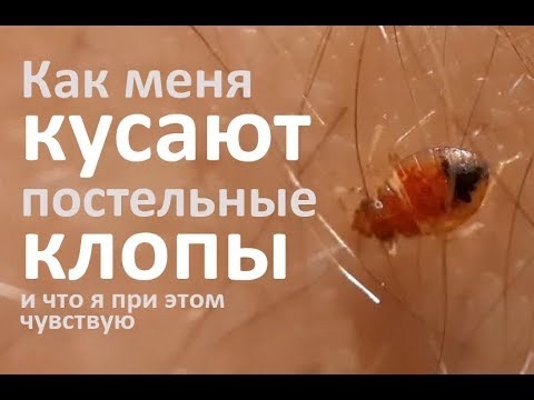 Что вызывает укусы на ночь кроме постельных клопов?