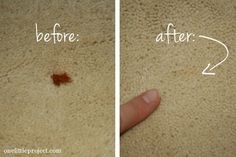 Comment éliminer les taches de taches brunes des punaises de lit