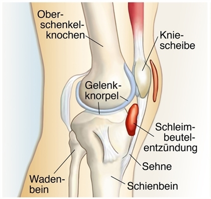 Was ist ein Sturz im Bau?