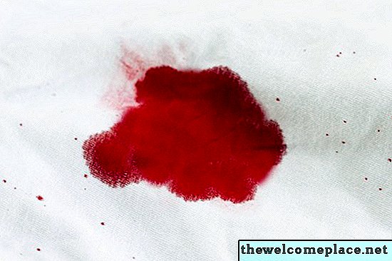 วิธีการเอาเลือดออกจากผ้าปูที่นอน