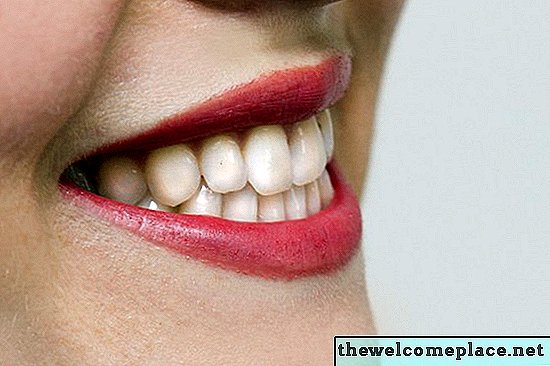 Odstraňování zubního kamene Home Remedy
